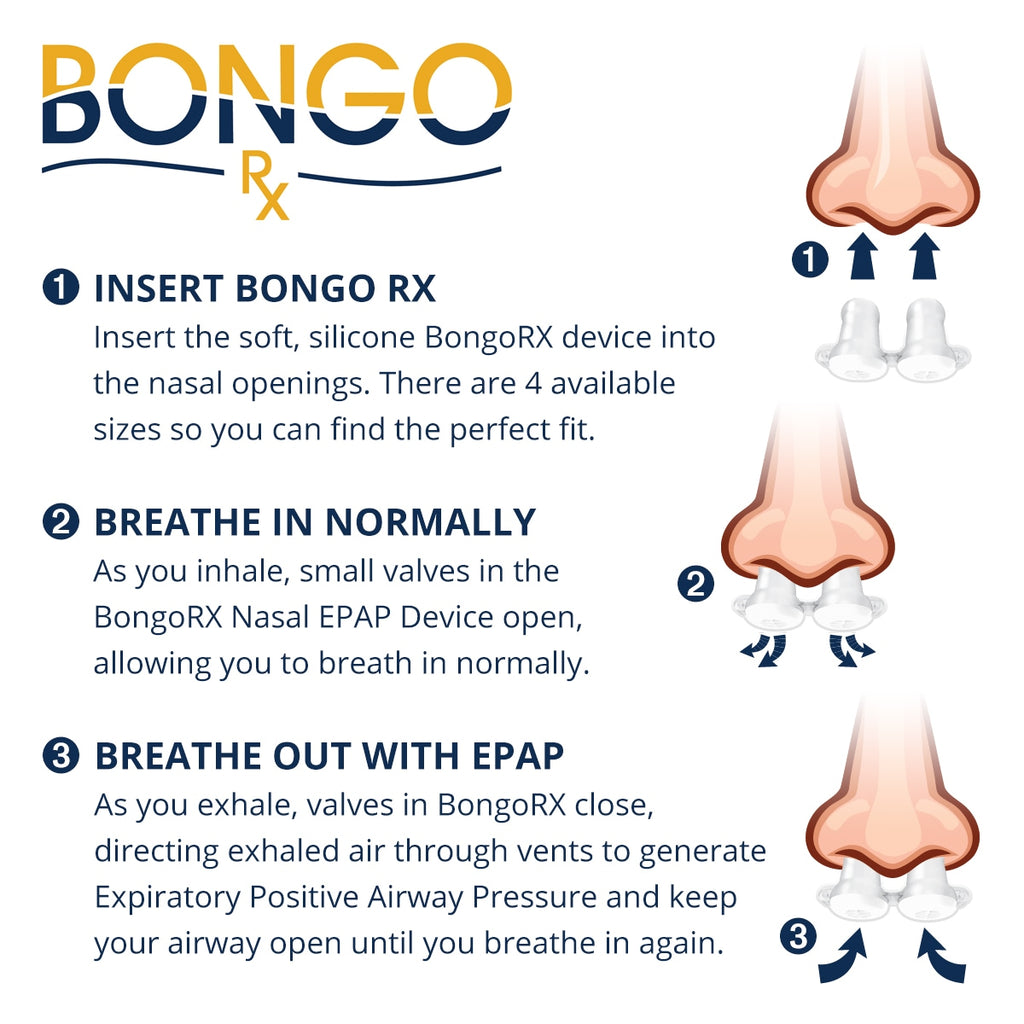 Bongo System Bongo RX EPAP Therapy Device Starter Kit – DirectHomeMedical